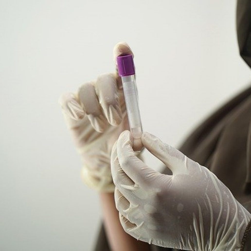 blood-test-5601437_640 blood-test-5601437_640